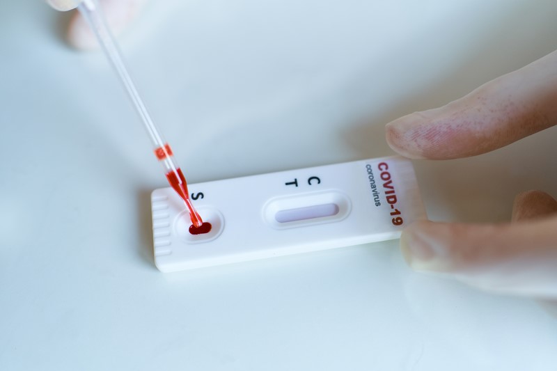 Je bekijkt nu Verlenging nultarief testkits tot 1 juli